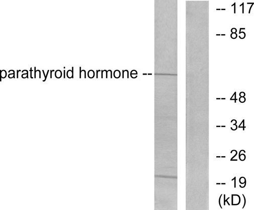 PTH / Parathyroid Hormone Antibody - Western blot analysis of lysates from A549 cells, using Parathyroid Hormone Antibody. The lane on the right is blocked with the synthesized peptide.