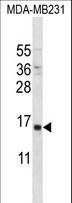 PTH / Parathyroid Hormone Antibody - PTH Antibody western blot of MDA-MB231 cell line lysates (35 ug/lane). The PTH antibody detected the PTH protein (arrow).