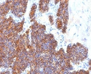 PTH / Parathyroid Hormone Antibody - Formalin-fixed, paraffin-embedded human parathyroid stained with Parathyroid Hormone antibody (PTH/1173).  This image was taken for the unmodified form of this product. Other forms have not been tested.