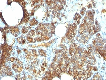 PTH / Parathyroid Hormone Antibody - Formalin-fixed, paraffin-embedded human parathyroid stained with Parathyroid Hormone antibody (PTH/1173).  This image was taken for the unmodified form of this product. Other forms have not been tested.