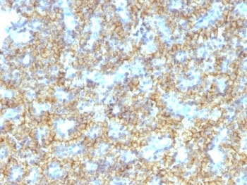 PTH / Parathyroid Hormone Antibody - Formalin-fixed, paraffin-embedded human parathyroid stained with PTH antibody (PTH/1174).  This image was taken for the unmodified form of this product. Other forms have not been tested.