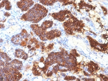 PTH / Parathyroid Hormone Antibody - Formalin-fixed, paraffin-embedded human parathyroid stained with PTH antibody (PTH/1175).  This image was taken for the unmodified form of this product. Other forms have not been tested.
