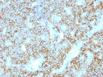 PTH / Parathyroid Hormone Antibody - Formalin-fixed, paraffin-embedded human parathyroid stained with PTH antibody (PTH/1175).  This image was taken for the unmodified form of this product. Other forms have not been tested.