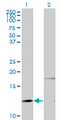 PTH / Parathyroid Hormone Antibody - Western blot of PTH expression in transfected 293T cell line by PTH monoclonal antibody (M11), clone 3G9.