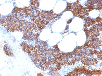 PTH / Parathyroid Hormone Antibody - Formalin-fixed, paraffin-embedded human Parathyroid stained with PTH Rabbit Recombinant Monoclonal Antibody (PTH/2295R).