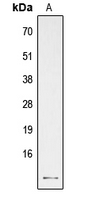 PTH / Parathyroid Hormone Antibody - Western blot analysis of PTH expression in human parathyroid gland (A) whole cell lysates.