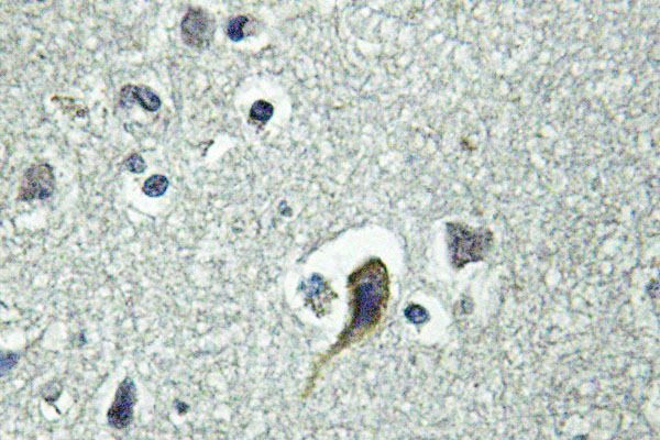 PTH / Parathyroid Hormone Antibody - IHC of PTH /PTHrP-R (L187) pAb in paraffin-embedded human brain muscle tissue.