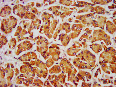 PTH / Parathyroid Hormone Antibody - IHC image of PTH Antibody diluted at 1:700 and staining in paraffin-embedded human pancreatic tissue performed on a Leica BondTM system. After dewaxing and hydration, antigen retrieval was mediated by high pressure in a citrate buffer (pH 6.0). Section was blocked with 10% normal goat serum 30min at RT. Then primary antibody (1% BSA) was incubated at 4°C overnight. The primary is detected by a biotinylated secondary antibody and visualized using an HRP conjugated SP system.