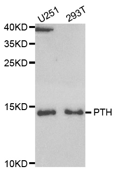 PTH / Parathyroid Hormone Antibody - Western blot analysis of extracts of various cell lines.