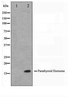 PTH / Parathyroid Hormone Antibody - Western blot of A549 cell lysate using Parathyroid Hormone Antibody