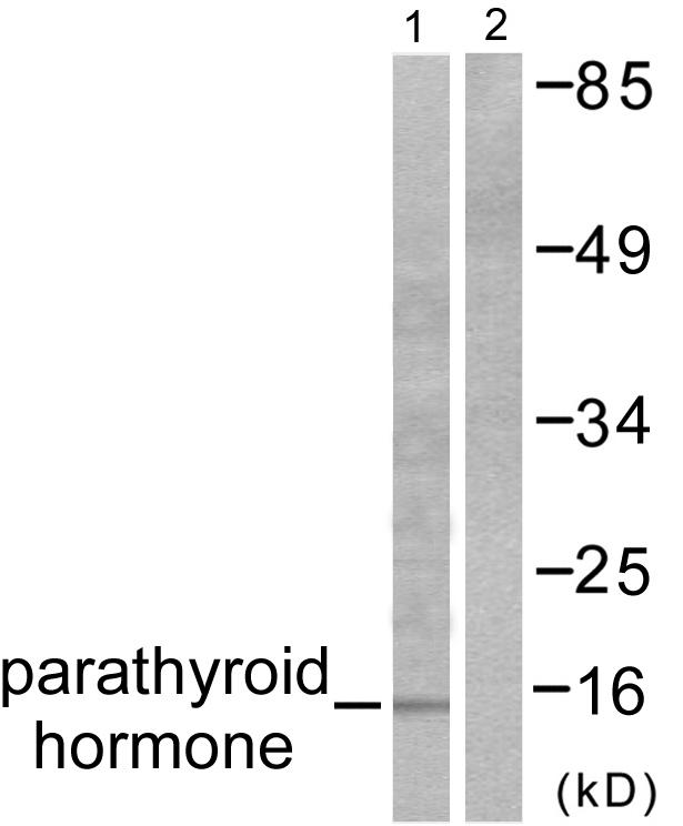 PTH / Parathyroid Hormone Antibody - Western blot analysis of extracts from A549 cells, using Parathyroid Hormone antibody.