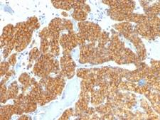 PTH / Parathyroid Hormone Antibody - Formalin-fixed, paraffin-embedded human parathyroid stained with Parathyroid Hormone antibody (PTH/911).  This image was taken for the unmodified form of this product. Other forms have not been tested.