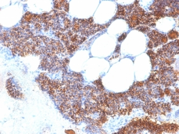 PTH / Parathyroid Hormone Antibody - Formalin-fixed, paraffin-embedded human parathyroid stained with Parathyroid Hormone antibody (SPM604).  This image was taken for the unmodified form of this product. Other forms have not been tested.