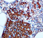 PTH / Parathyroid Hormone Antibody - IHC of Parathyroid Hormone on FFPE Parathyroid tissue. This image was taken for the unmodified form of this product. Other forms have not been tested.