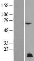 PTH / Parathyroid Hormone Protein - Western validation with an anti-DDK antibody * L: Control HEK293 lysate R: Over-expression lysate