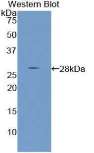PTHLH / PTHRP Antibody - Western blot of recombinant PTHLH / PTHRP.  This image was taken for the unconjugated form of this product. Other forms have not been tested.