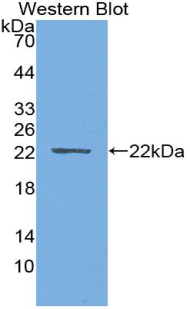 PTHLH / PTHRP Antibody - Western blot of recombinant PTHLH / PTHRP.