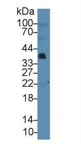 PTHLH / PTHRP Antibody - Western Blot; Sample: Human Serum; Primary Ab: 3µg/ml Mouse Anti-Human Hpt Antibody Second Ab: 0.2µg/mL HRP-Linked Caprine Anti-Mouse IgG Polyclonal Antibody