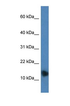 PTHLH / PTHRP Antibody - PTHLH / PTHRP antibody Western blot of Mouse Brain lysate. Antibody concentration 1 ug/ml. This image was taken for the unconjugated form of this product. Other forms have not been tested.