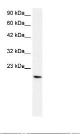 PTHLH / PTHRP Antibody - HepG2 Cell Lysate.  This image was taken for the unconjugated form of this product. Other forms have not been tested.