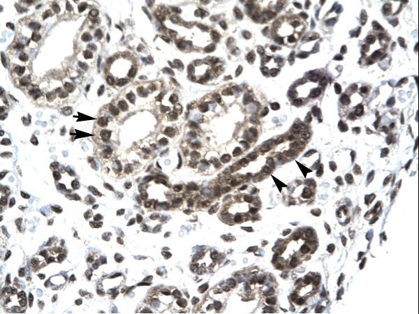 PTHLH / PTHRP Antibody - PTHLH / PTHRP antibody ARP33885_T100-NP_002811-PTHLH (parathyroid hormone-like hormone) Antibody was used in IHC to stain formalin-fixed, paraffin-embedded human kidney.  This image was taken for the unconjugated form of this product. Other forms have not been tested.
