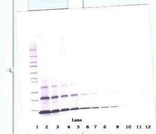 PTHLH / PTHRP Antibody - Western Blot (non-reducing) of PTHRP antibody