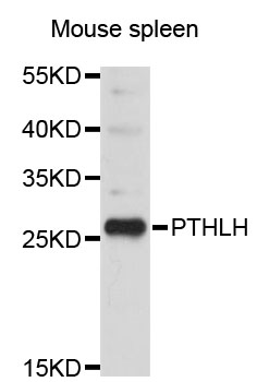 PTHLH / PTHRP Antibody - Western blot analysis of extracts of Mouse spleen cells.