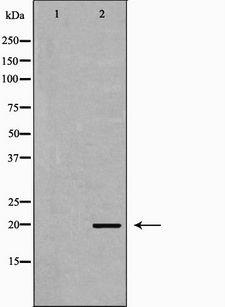 PTHLH / PTHRP Antibody - Western blot analysis of extracts of A549 cells using PTHLH antibody. The lane on the left is treated with the antigen-specific peptide.