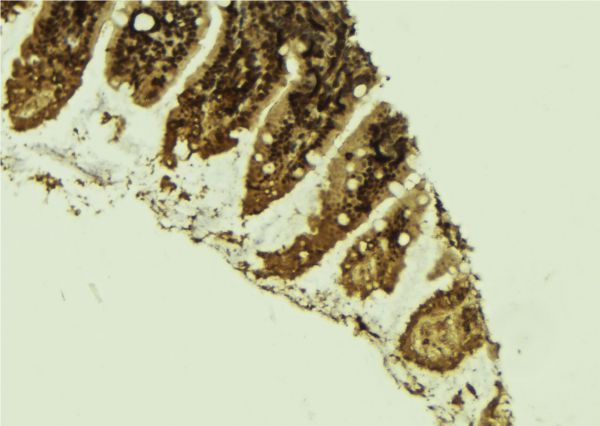 PTHLH / PTHRP Antibody - 1:100 staining mouse colon tissue by IHC-P. The sample was formaldehyde fixed and a heat mediated antigen retrieval step in citrate buffer was performed. The sample was then blocked and incubated with the antibody for 1.5 hours at 22°C. An HRP conjugated goat anti-rabbit antibody was used as the secondary.