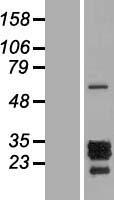 PTHLH / PTHRP Protein - Western validation with an anti-DDK antibody * L: Control HEK293 lysate R: Over-expression lysate