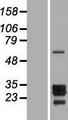 PTHLH / PTHRP Protein - Western validation with an anti-DDK antibody * L: Control HEK293 lysate R: Over-expression lysate