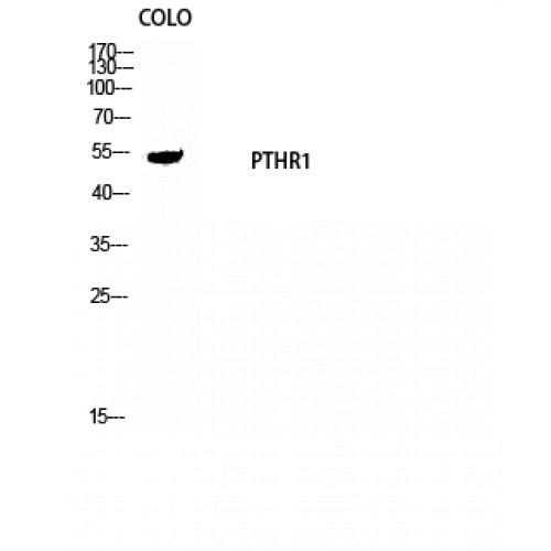 PTHR / PTHR1 Antibody - Western blot of PTH/PTHrP-R antibody