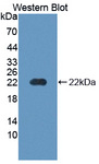 PTHR / PTHR1 Antibody - Western blot of PTHR / PTHR1 antibody.