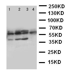 PTHR / PTHR1 Antibody - WB of PTHR / PTHR1 antibody. Lane 1: SKOV Cell Lysate. Lane 2: U20S Cell Lysate. Lane 3: HELA Cell Lysate. Lane 4: SMMC Cell Lysate.