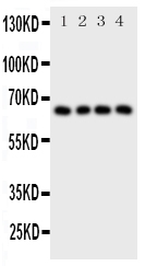 PTHR / PTHR1 Antibody - Anti-Parathyroid Hormone Receptor 1 antibody, Western blotting All lanes: Anti Parathyroid Hormone Receptor 1 at 0.5ug/ml Lane 1: SKOV Whole Cell Lysate at 40ug Lane 2: U20S Whole Cell Lysate at 40ug Lane 3: HELA Whole Cell Lysate at 40ug Lane 4: SMMC Whole Cell Lysate at 40ug Predicted bind size: 66KD Observed bind size: 66KD