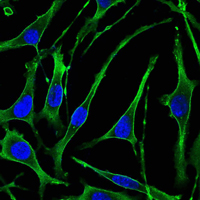PTHR / PTHR1 Antibody - Immunofluorescence of SK-BR-3 cells using PTH1R mouse monoclonal antibody (green). Blue: DRAQ5 fluorescent DNA dye.