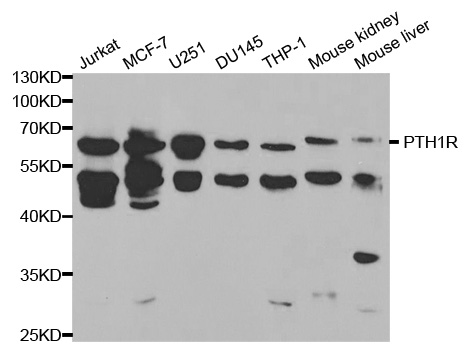 PTHR / PTHR1 Antibody - Western blot analysis of extracts of various cell lines, using PTH1R antibody at 1:1000 dilution. The secondary antibody used was an HRP Goat Anti-Rabbit IgG (H+L) at 1:10000 dilution. Lysates were loaded 25ug per lane and 3% nonfat dry milk in TBST was used for blocking.