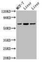 PTHR / PTHR1 Antibody - Positive Western Blot detected in Rat liver tissue, Mouse liver issue. All lanes: PTH1R antibody at 2 µg/ml Secondary Goat polyclonal to rabbit IgG at 1/50000 dilution. Predicted band size: 67 KDa. Observed band size: 67 KDa