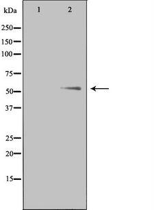 PTHR / PTHR1 Antibody - Western blot analysis of extracts of Jurkat cells using PTHR1 antibody. The lane on the left is treated with the antigen-specific peptide.