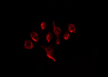 PTHR / PTHR1 Antibody - Staining HeLa cells by IF/ICC. The samples were fixed with PFA and permeabilized in 0.1% Triton X-100, then blocked in 10% serum for 45 min at 25°C. The primary antibody was diluted at 1:200 and incubated with the sample for 1 hour at 37°C. An Alexa Fluor 594 conjugated goat anti-rabbit IgG (H+L) Ab, diluted at 1/600, was used as the secondary antibody.