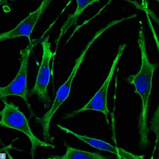 PTHR / PTHR1 Antibody - Immunofluorescence (IF) analysis of SK-BR-3 cells using PTH/PTHrP-R Monoclonal Antibody (green). Blue: DRAQ5 fluorescent DNA dye.