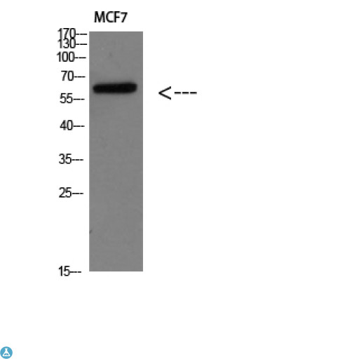 PTHR / PTHR1 Antibody - Western blot analysis of MCF7 Cell Lysate, antibody was diluted at 1:1000. Secondary antibody was diluted at 1:20000.