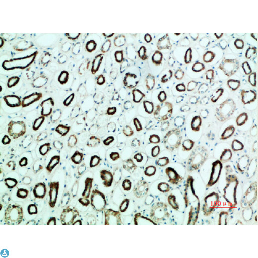 PTHR / PTHR1 Antibody - Immunohistochemical analysis of paraffin-embedded human-kidney, antibody was diluted at 1:200.