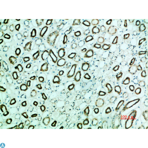 PTHR / PTHR1 Antibody - Immunohistochemical analysis of paraffin-embedded human-kidney, antibody was diluted at 1:200.