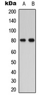 PTHR / PTHR1 Antibody - Western blot analysis of PTHR1 expression in HEK293T (A); COLO205 (B) whole cell lysates.