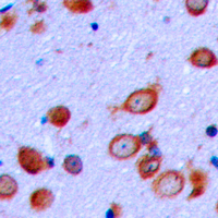PTHR / PTHR1 Antibody - Immunohistochemical analysis of PTHR1 staining in human brain formalin fixed paraffin embedded tissue section. The section was pre-treated using heat mediated antigen retrieval with sodium citrate buffer (pH 6.0). The section was then incubated with the antibody at room temperature and detected using an HRP-conjugated compact polymer system. DAB was used as the chromogen. The section was then counterstained with hematoxylin and mounted with DPX.