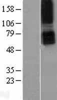 PTHR / PTHR1 Protein - Western validation with an anti-DDK antibody * L: Control HEK293 lysate R: Over-expression lysate