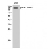 PTK2B / PYK2 Antibody - Western blot of Phospho-PYK2 (Y580) antibody