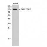 PTK2B / PYK2 Antibody - Western blot of Phospho-PYK2 (Y881) antibody