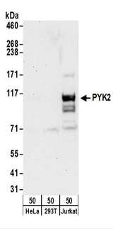 PTK2B / PYK2 Antibody - Detection of Human PYK2 by Western Blot. Samples: Whole cell lysate (50 ug) from HeLa, 293T, and Jurkat cells. Antibodies: Affinity purified rabbit anti-PYK2 antibody used for WB at 0.4 ug/ml. Detection: Chemiluminescence with an exposure time of 30 seconds.